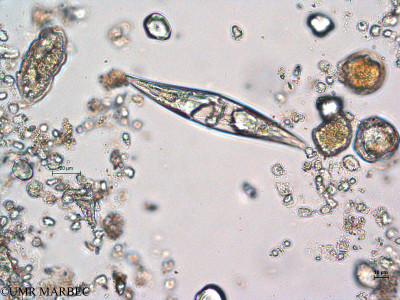 phyto/Thau_Lagoon/THAU_station1/GELAMED 2010/Pleurosigma sp3 et Warnowia sp (P cf angulatum)(copy)_thumb.jpg